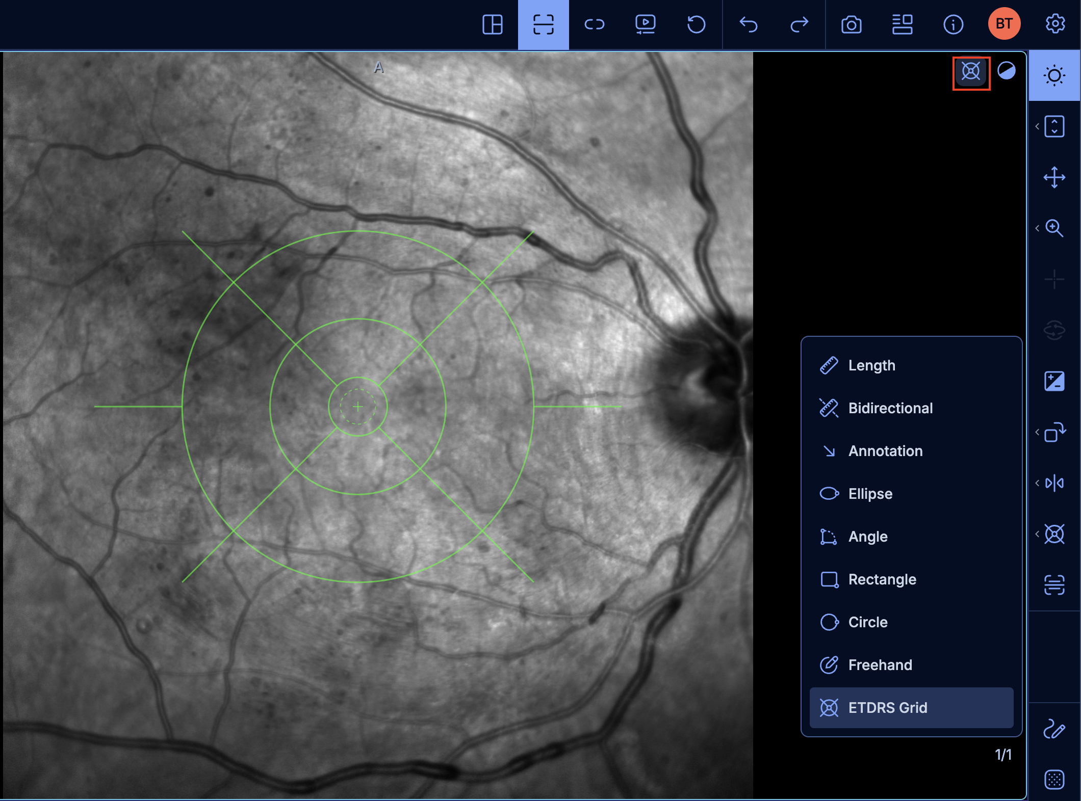 ETDRS grid tool activation