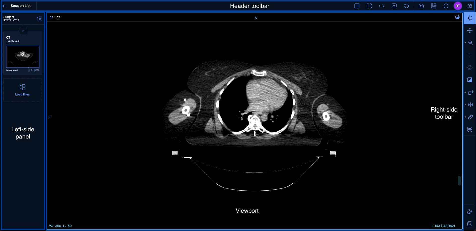 Viewer overview